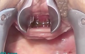 Masturbate Peehole with Toothbrush coupled with Radiogram into Urethra