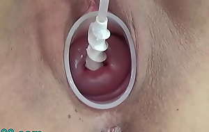 Milf Cervix Insertion with snake catheter for insemination plus vibrator Jav Extreme